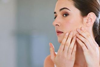 Πώς να αντιμετωπίσεις την ακμή