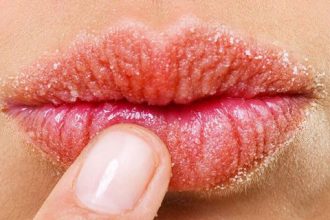 Πώς να αποκτήσετε χείλη για φίλημα!