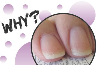 Ξεφλουδίζουν τα νύχια σου; Μάθε γιατί!