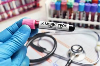 Ευλογιά των πιθήκων: Ανησυχία στην Ευρώπη μετά το κρούσμα στη Σουηδία - Είμαστε έτοιμοι για 10 εκατ. εμβόλια λέει φαρμακευτική εταιρεία
