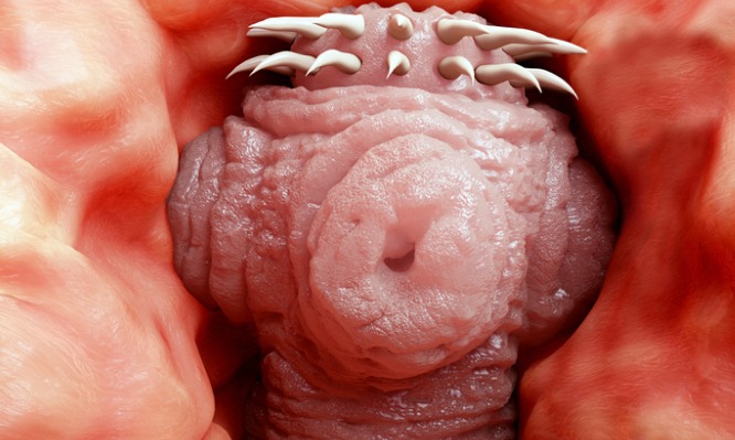 Τα 10 σημάδια που δείχνουν ότι έχετε παράσιτα στο έντερο!