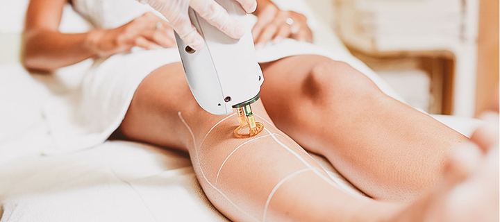 Αποτρίχωση με laser: Όλα όσα πρέπει να γνωρίζετε