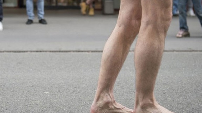 Πάτρα: ΣΟΚ άνδρας κυκλοφορούσε σχεδόν γυμνός με σκισμένα ρούχα!