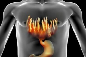 Δυσπεψία: Ποια τα βασικά συμπτώματα - Πώς θα την αντιμετωπίσετε