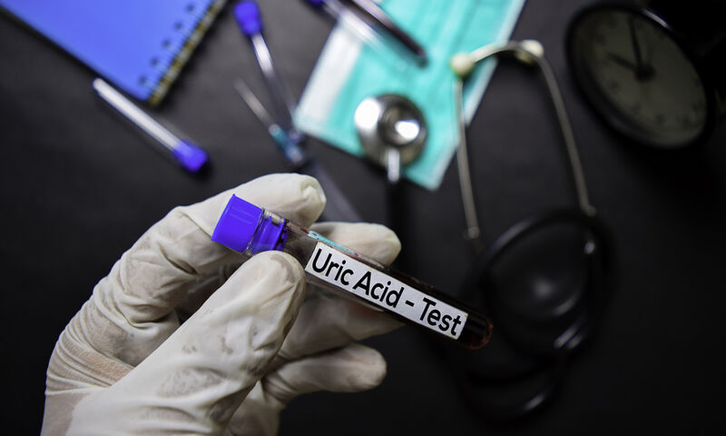 Ουρικό οξύ: 10 τροφές που πρέπει να αποφεύγετε