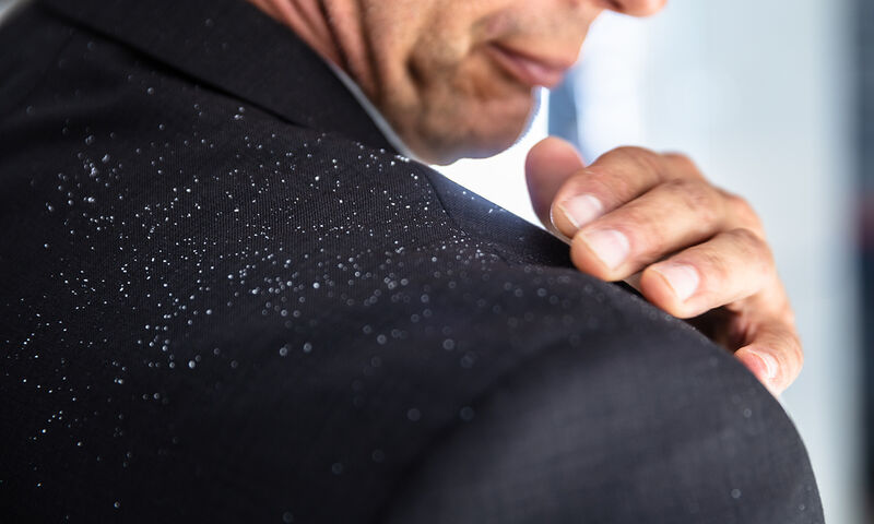 Πιτυρίδα: 4 εναλλακτικές θεραπείες σε εικόνες