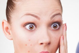 Αυτό το τρικ για τα σπυράκια είναι μαγικό!