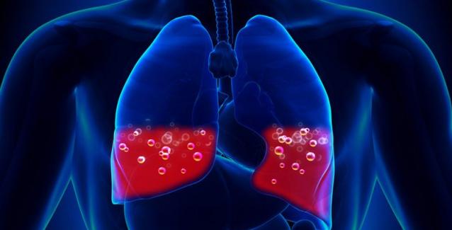 Σε εξέλιξη πολυκεντρική μελέτη για πνευμονική ίνωση λόγω κορονοϊού