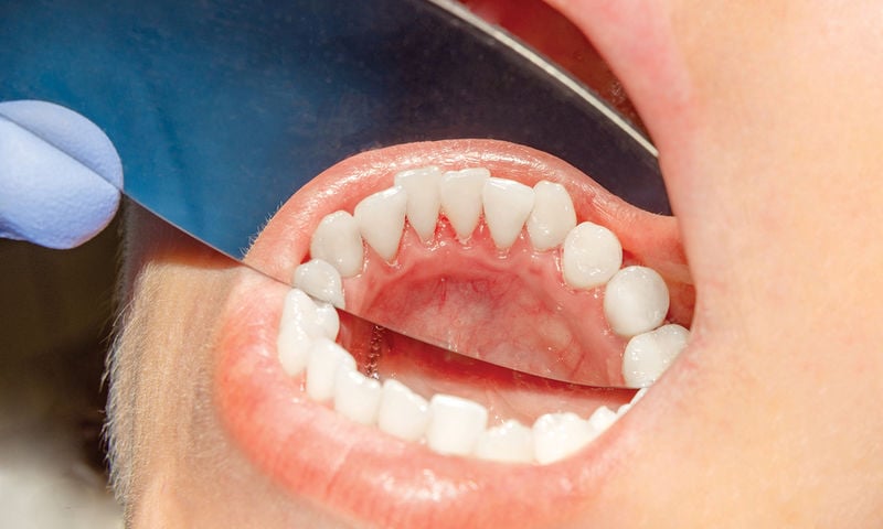 8 συμπτώματα του στόματος που δεν πρέπει να αγνοήσεις