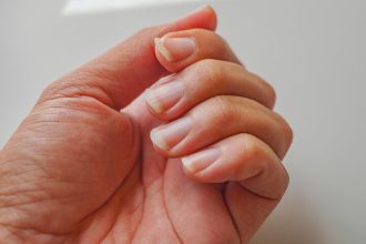 Νύχια: Οι 7 καθημερινές συνήθειες που τα καταστρέφουν