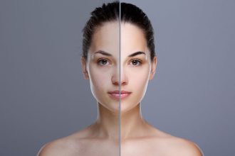 Πανάδες: Γιατί εμφανίζονται και πώς θα τις αντιμετωπίσετε