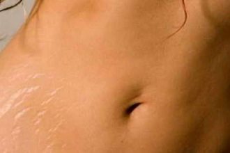 Ραγάδες: 4 «τρικ» για να τις απομακρύνετε οριστικά