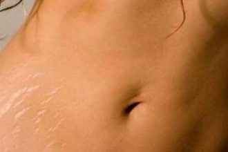 Ραγάδες: 4 «τρικ» για να τις απομακρύνετε οριστικά