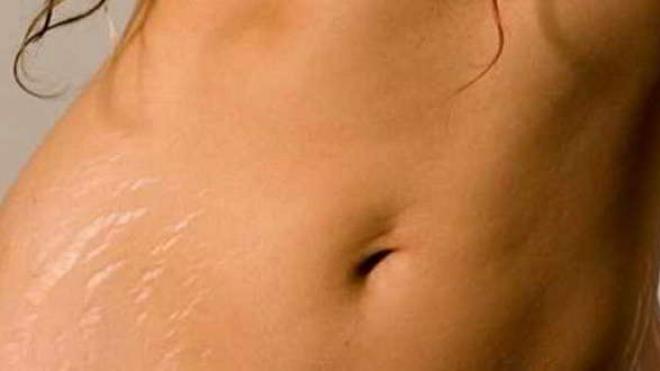 Ραγάδες: 4 «τρικ» για να τις απομακρύνετε οριστικά