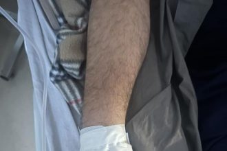 Αχαΐα: Το μήνυμα του δημάρχου από το νοσοκομείο "Πολύ σύντομα θα είμαι πάλι ενεργός"