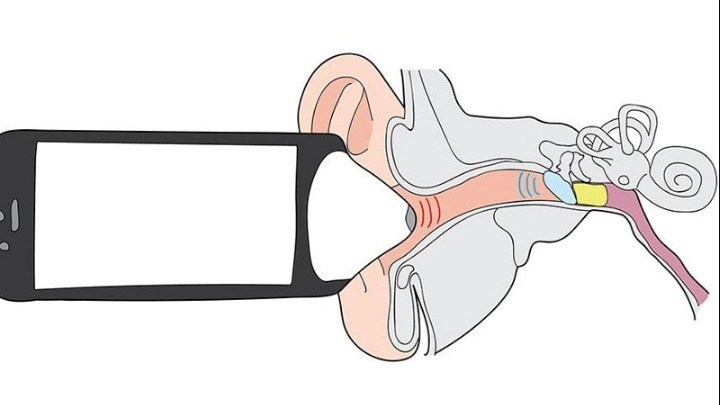 "Έξυπνη" εφαρμογή κινητού ανιχνεύει την ωτίτιδα στα παιδιά