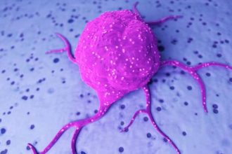 Εξατομικευμένη προσέγγιση κατά του καρκίνου