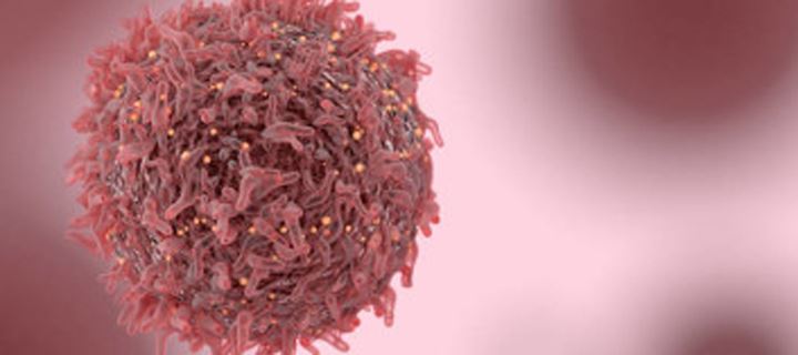 O καρκίνος μπορεί να περάσει στην πρώτη θέση των αιτιών θανάτου στην Ελλάδα