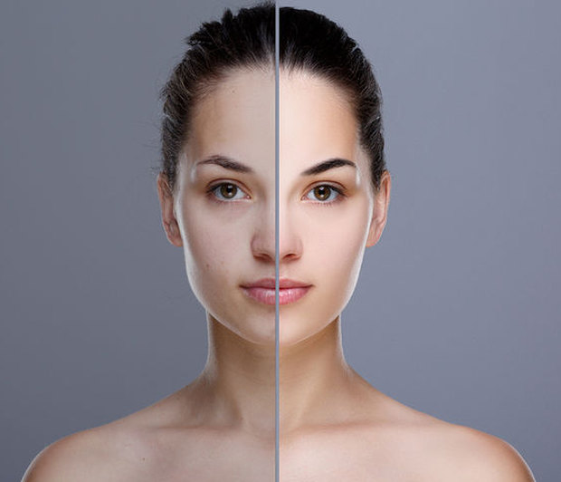 Πανάδες: Γιατί εμφανίζονται και πώς θα τις αντιμετωπίσετε