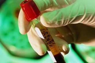 Εθνικό σχέδιο δράσης για την αντιμετώπιση της ηπατίτιδας C