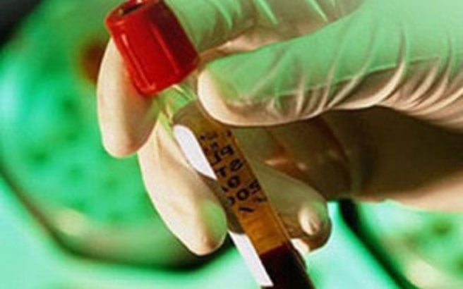 Εθνικό σχέδιο δράσης για την αντιμετώπιση της ηπατίτιδας C