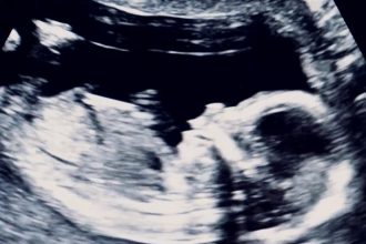 Η ιστορία της Τάνιας που θα γίνει μητέρα στα 52 της – «Όλα άλλαξαν όταν…»