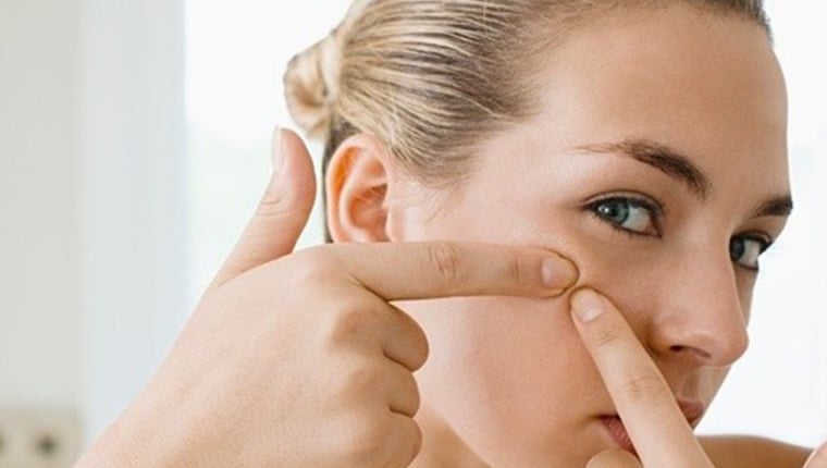 Πείτε αντίο στα σημάδια της ακμής