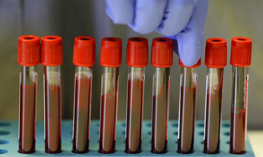 ΕΟΠΥΥ: Ηλεκτρονική συνταγογράφηση για τη διάγνωση του κληρονομούμενου καρκίνου μαστού και ωοθηκών - Πώς αποζημιώνονται οι εξετάσεις