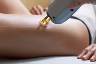 Οι θεραπείες ομορφιάς που πρέπει να αποφεύγεις το καλοκαίρι