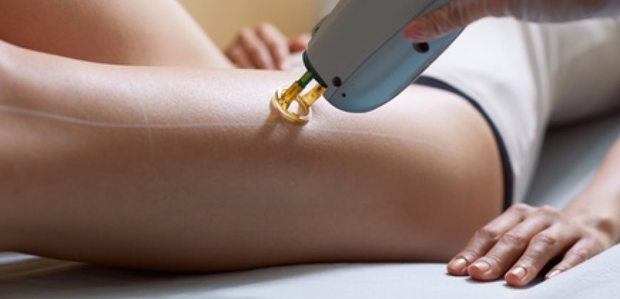 Οι θεραπείες ομορφιάς που πρέπει να αποφεύγεις το καλοκαίρι