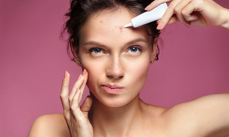 Ακμή: Ποιοι παράγοντες οδηγούν σε εξάρσεις