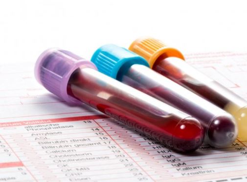 Εξέταση αίματος ανιχνεύει με 83% ακρίβεια τον καρκίνο του παχέος εντέρου