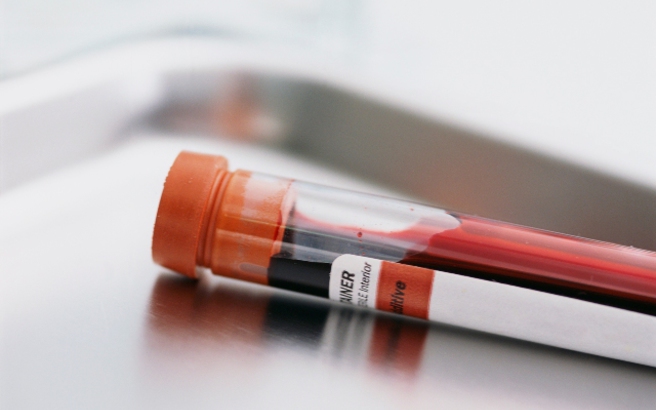 Νέο τεστ υπολογίζει πότε θα θεραπευτεί ασθενής με διάσειση