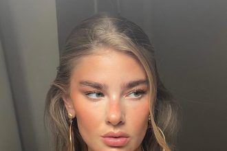 Σκέφτεστε να κάνετε Botox στα φρύδια; Τι πρέπει να γνωρίζετε πριν το δοκιμάσετε