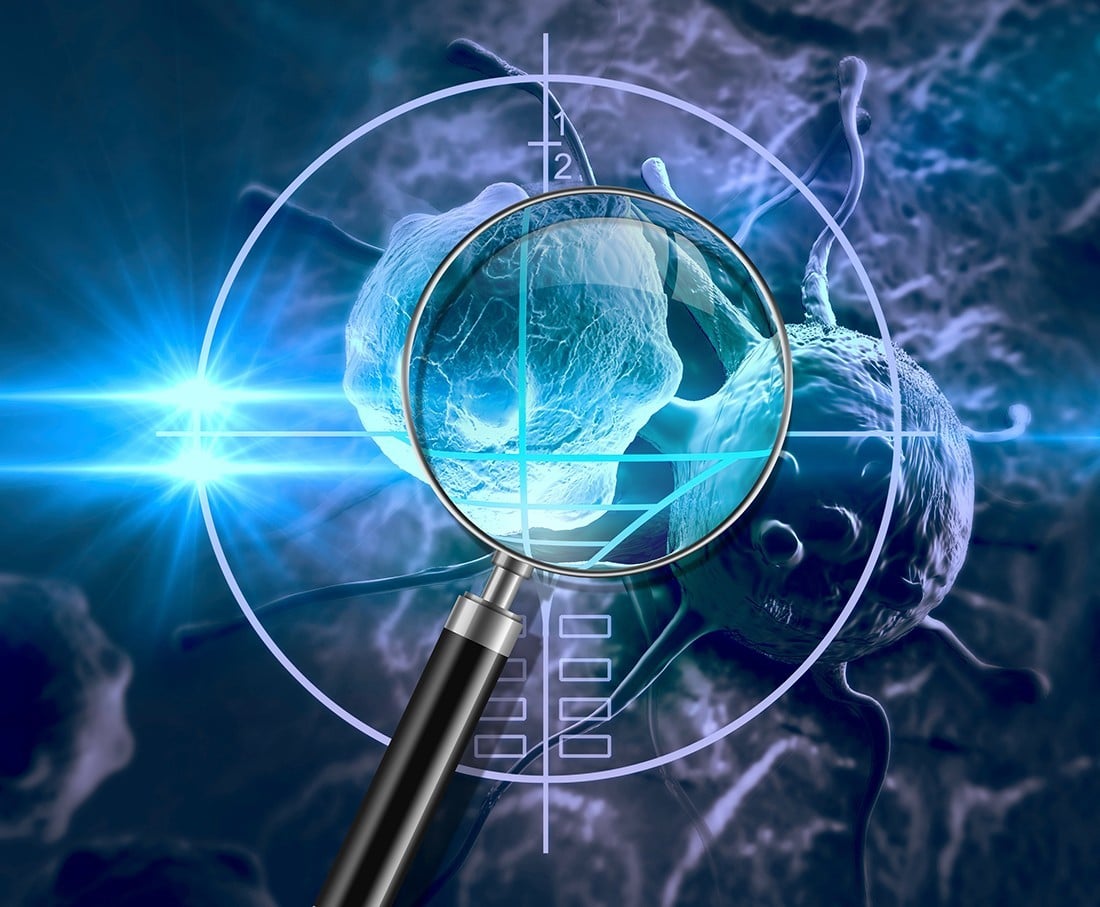 Καρκίνος παχέος εντέρου: Η ανακάλυψη που ανοίγει το δρόμο σε νέες θεραπείες