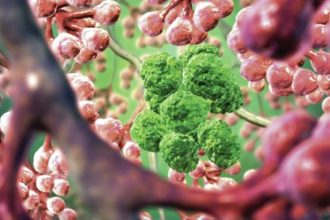 Η νανοϊατρική στη μάχη κατά του καρκίνου