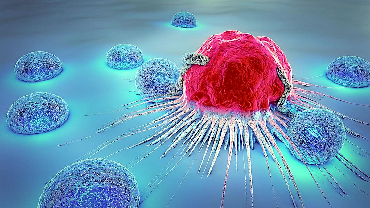 Πάτρα: Μετεκπαιδευτικό Συνέδριο - «Εξελίξεις στην Ογκολογία», στις 9 & 10 Δεκεμβρίου