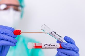 Κορονοϊός: 27 νεκροί, 24 διασωληνωμένοι και 594 εισαγωγές