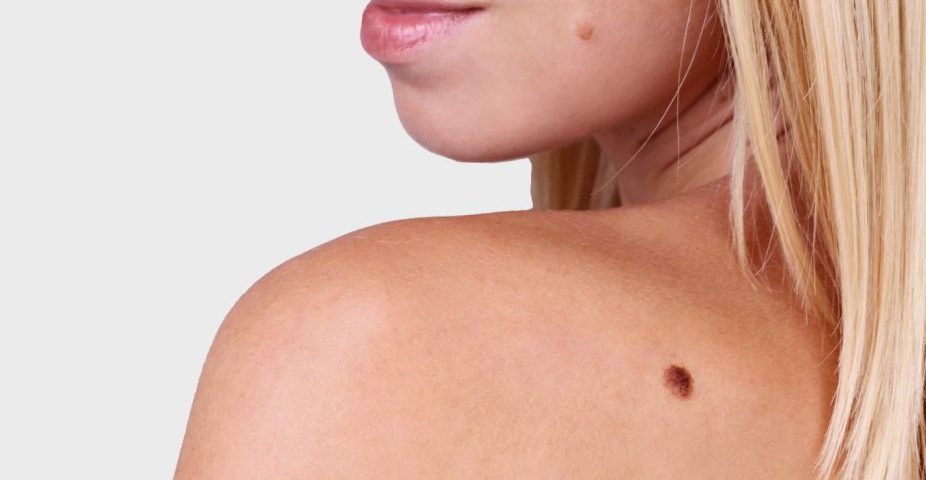 Ενημερωτική διαδικτυακή ημερίδα για τον καρκίνο του δέρματος