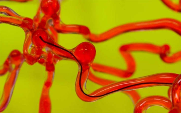 Το ρομποτικό «φιδάκι» που θα μας σώζει από τα εγκεφαλικά