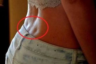 Τι είναι το «λακκάκι» που ορισμένοι έχουν στη μέση