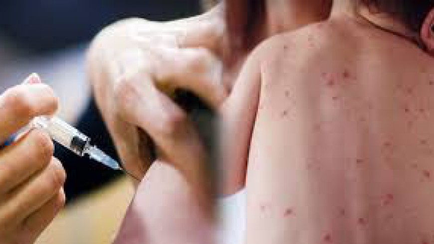 Προβληματισμός και ανησυχία για τα κρούσματα ιλαράς στην Αχαΐα - ΣΤΟΙΧΕΙΑ ΚΕΕΛΠΝΟ