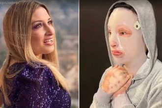 Επίθεση με βιτριόλι: Τα δώρα που συγκίνησαν την Ιωάννα