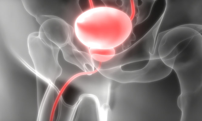 Νέα μέθοδος πολυπαραμετρικών υπερήχων για τη διάγνωση καρκίνων του προστάτη