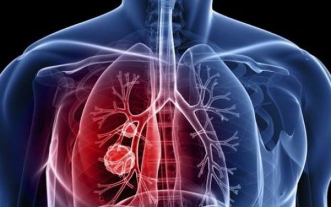 Οι ιοί «σύμμαχοι» των επιστημόνων στη μάχη με τον καρκίνο