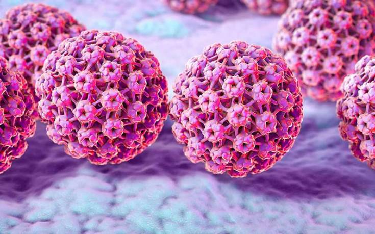 Κονδυλώματα: Τι είναι και πως αντιμετωπίζονται