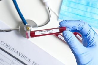 Θετικός στον κορoνοϊό ο υφυπουργός Ανάπτυξης και Επενδύσεων Χρίστος Δήμας