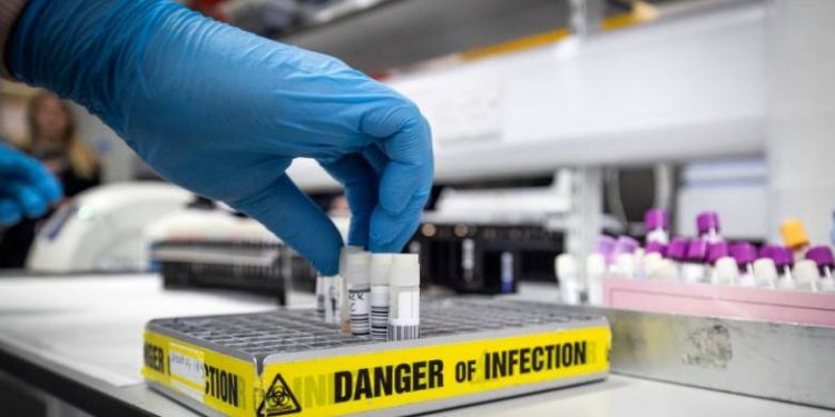 Κορoνοϊός: Επηρεάζει τον εγκέφαλο χρόνια μετά τη νόσηση