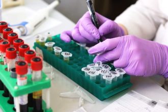 Οι θάνατοι από καρκίνο στους άνδρες προβλέπεται να αυξηθούν κατά 93% έως το 2050, προειδοποιεί νέα μελέτη
