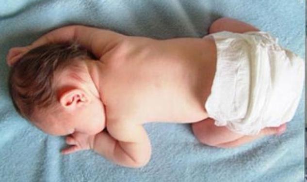 Πώς ένα απλό εμβόλιο προλαμβάνει την οξεία γαστρεντερίτιδα σε βρέφη